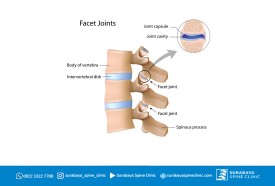 Facet Joint Lumbal, Symptomps and Diagnosis